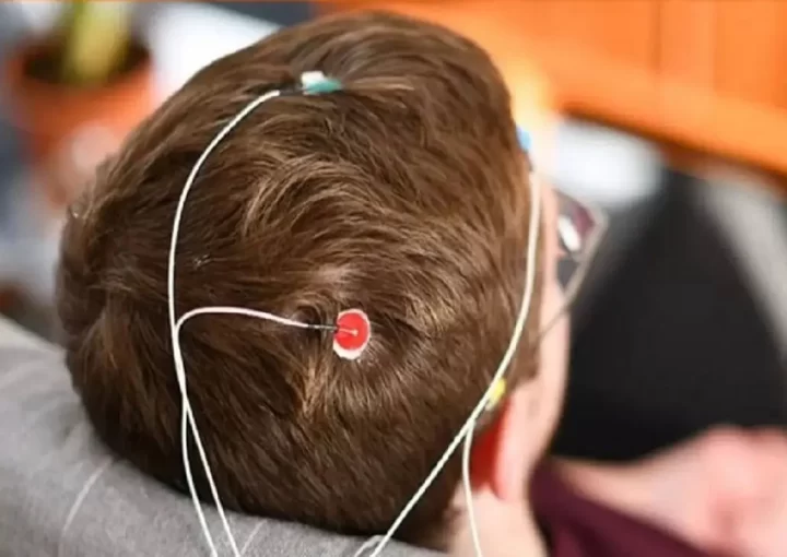 علائم بیماری ام اس در زنان