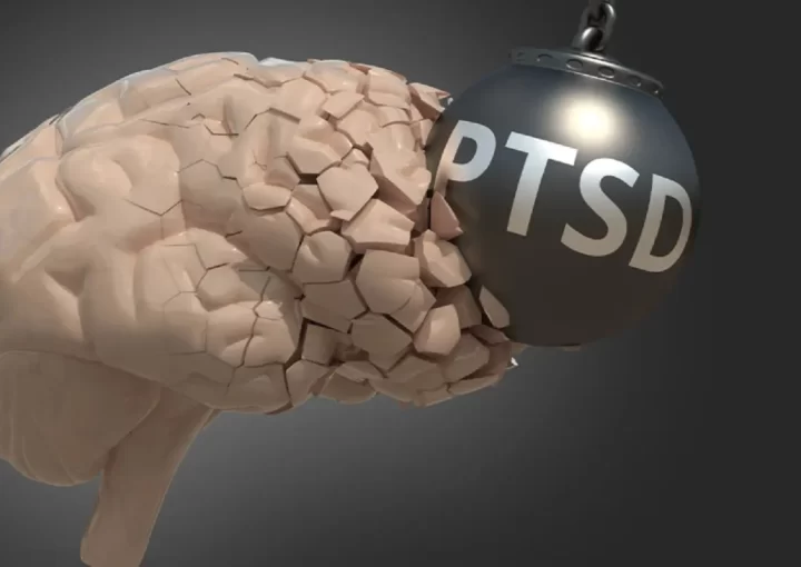 اختلال استرس پس از سانحه (PTSD)