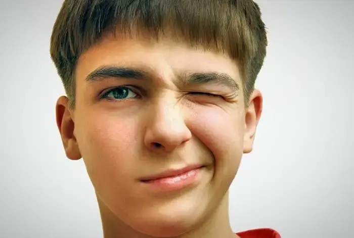 درمان تیک عصبی