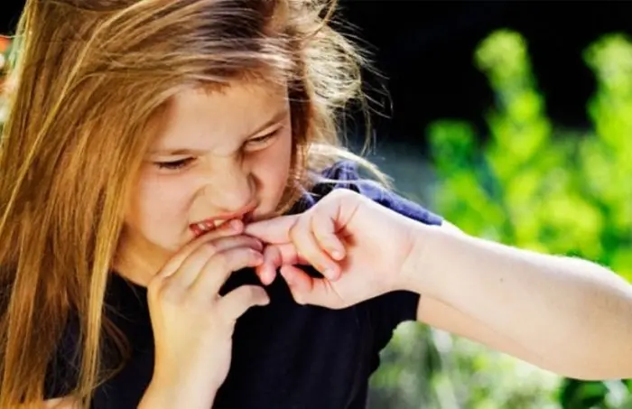 درمان تیک عصبی