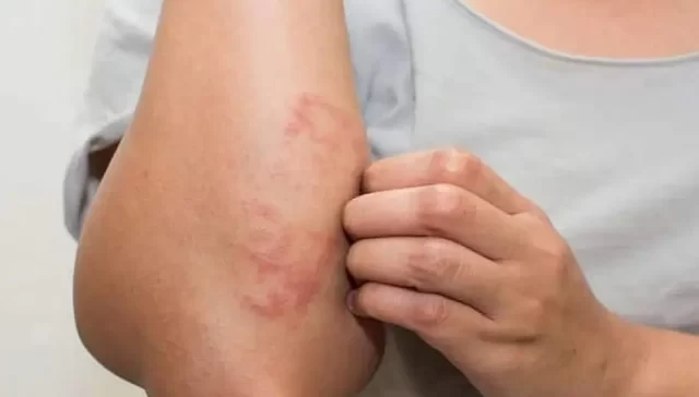 مشکلات کبدی و علائم آن