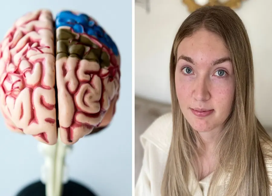 درمان بیماری های عصبی در سوئد